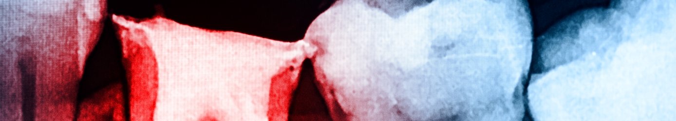 Chirurgia stomatologiczna Garwolin